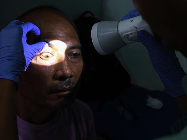 Operasi Katarak untuk Warga Tak Mampu di Medan