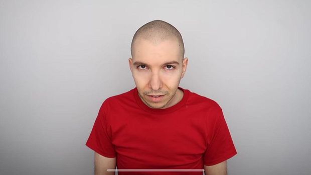Penampilan Youtuber Mukbang Nikocado Avocado usai Turun BB 113 Kg Bikin Syok