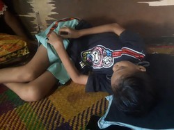 Bocah Bernama Yola di Ogan Ilir Alami Gizi Buruk, Dinkes Bantu Urus BPJS