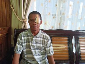 Program JKN Bantu Warga Asal Sintang Dapatkan Pelayanan Operasi Mata