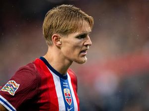 Martin Odegaard Cedera, Mikel Arteta Ungkap Kondisinya