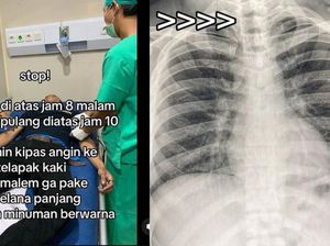 Viral Penampakan Paru-paru Basah Disebut gegara Kipas Angin, Ini Catatan Dokter Viral Penampakan Paru-paru Basah Disebut gegara Kipas Angin, Ini Catatan Dokter
