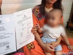 Balita di Palembang Alami Kelamin Ganda, Butuh Bantuan Pengobatan