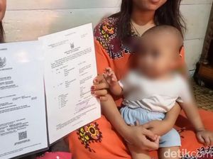 Balita di Palembang Alami Kelamin Ganda, Butuh Bantuan Pengobatan Balita di Palembang Alami Kelamin Ganda, Butuh Bantuan Pengobatan