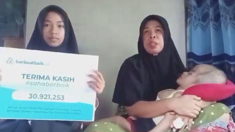 Berartinya Donasi Sahabat Baik untuk Rizki, Bocah Penderita Hidrosefalus