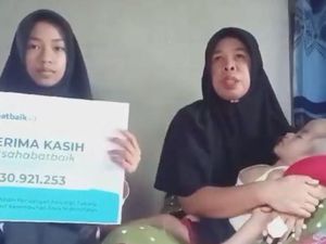 Berartinya Donasi Sahabat Baik untuk Rizki, Bocah Penderita Hidrosefalus
