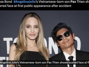 Penampilan Perdana Anak Angelina Jolie Usai Keluar ICU, Ada Bekas Luka di Dahi