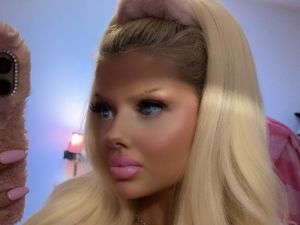 Wanita Habiskan Rp 160 Juta untuk Oplas Mirip Barbie, Diejek Mirip Badut Wanita Habiskan Rp 160 Juta untuk Oplas Mirip Barbie, Diejek Mirip Badut