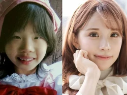 Viral Influencer Habiskan Rp 2 M demi Operasi Plastik, Parasnya Bikin Melongo Viral Influencer Habiskan Rp 2 M demi Operasi Plastik, Parasnya Bikin Melongo