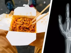 Gegara Curi Makanan Teman Sekamar, Kaki Pria Ini Diamputasi