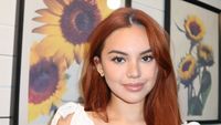 8 Foto Shafa Harris Oplas di Korea, Dipuji Makin Cantik Dengan Hidung Mancung