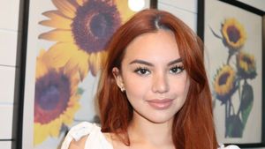 8 Foto Shafa Harris Oplas di Korea, Dipuji Makin Cantik Dengan Hidung Mancung