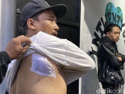Kesaksian Pemilik Warkop Sukabumi yang Ditembak Oknum Advokat dalam Mercy
