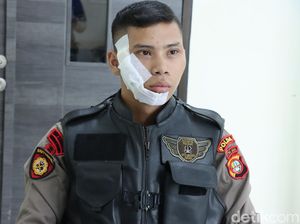Detik-detik Anggota Patroli Disiram Air Keras Pelaku Tawuran di Jakbar
