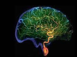 Makin Parah, Mikroplastik Sudah Menyusup ke Jaringan Otak Manusia