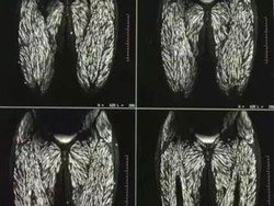 Rontgen Tubuh Wanita Penuh Parasit Akibat Sering Makan Babi Mentah