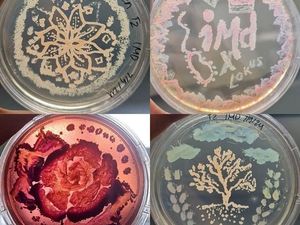 Mahasiswa ITB Bikin Petri-dish Art, Seni Lukis Menakjubkan dari Kumpulan Mikroba Mahasiswa ITB Bikin Petri-dish Art, Seni Lukis Menakjubkan dari Kumpulan Mikroba