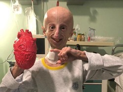 Sammy Basso, Penyintas Penyakit Langka yang Tua Sejak Lahir Meninggal Dunia