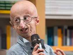 Video: Sosok Sammy Basso, Pengidap Penyakit Genetik Langka Meninggal Dunia