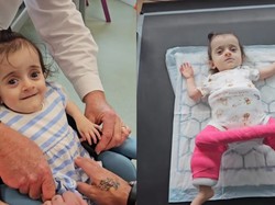 Pilu Bayi Natarlia Idap Tulang Rapuh, Tak Bisa Dipeluk Erat Ortu