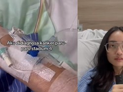 Wanita Jakbar Kena Kanker Paru Stadium 4, Sempat Alami Nyeri Dada Seperti Ini