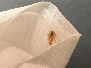 Ngeri, Kutu Busuk Terlihat di Penerbangan Kelas Utama