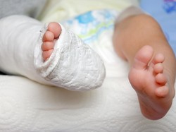 3 Orang Terluka Akibat Pohon Tumbang di Cibinong, Termasuk Seorang Balita