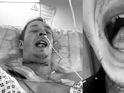 Fakta-fakta Pria di Inggris Idap Kanker Mulut, Awalnya Cuma Ngeluh Sariawan