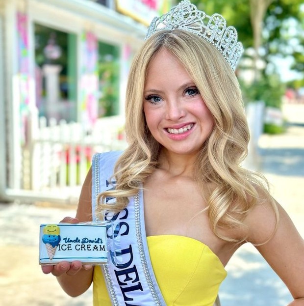 Kisah inspirasi Kayla Kosmalski