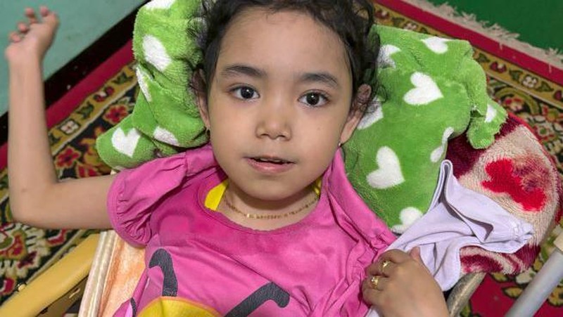 Nazila Penderita Penyempitan Otak Semakin Sehat Berkat Sahabat Baik