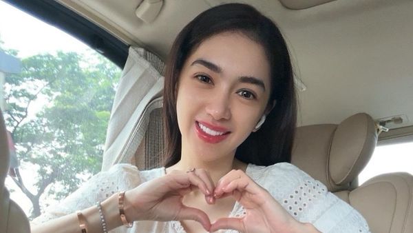 Tampilan Muda Angel Karamoy Usai Operasi Hidung