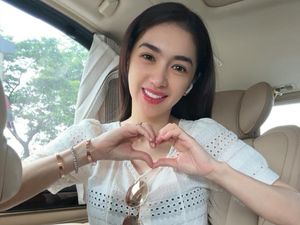 Tampilan Muda Angel Karamoy Usai Operasi Hidung