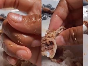 Viral Tak Sengaja Menelan Belatung saat Makan, Harus Gimana? Ini Saran Dokter Viral Tak Sengaja Menelan Belatung saat Makan, Harus Gimana? Ini Saran Dokter