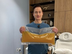 Miliarder 47 Tahun Menolak Tua, Ganti Plasma Darah Demi Jadi Usia 18 Lagi