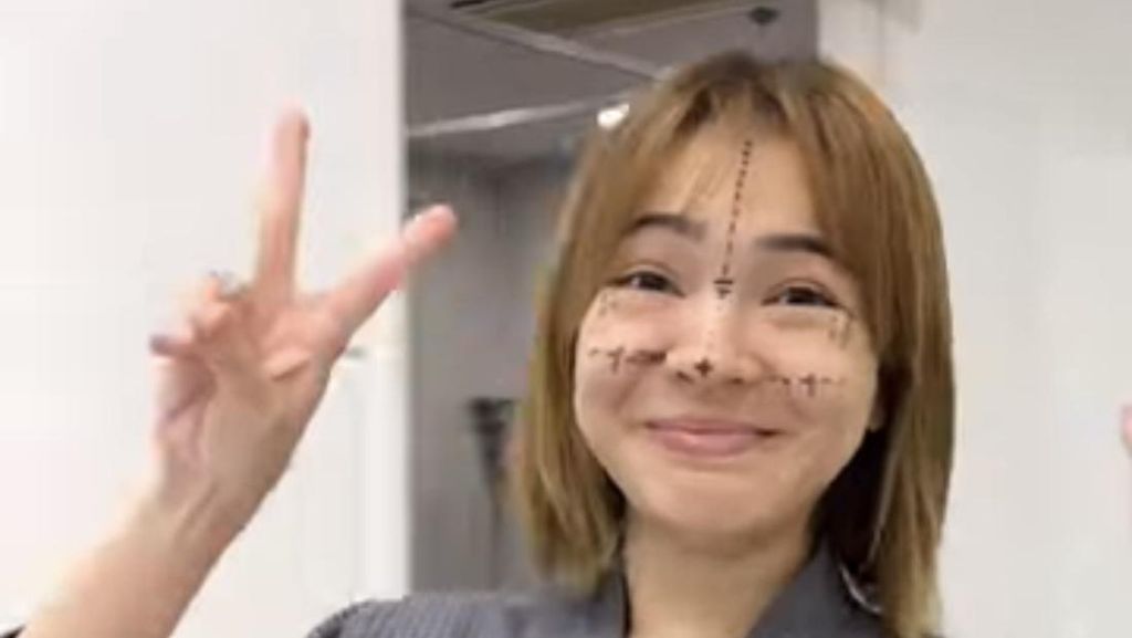 7 Foto Maya Septha Oplas di Korea, Koreksi Hidung-Rahang Agar Lebih Simetris 7 Foto Maya Septha Oplas di Korea, Koreksi Hidung-Rahang Agar Lebih Simetris