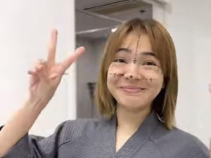 7 Foto Maya Septha Oplas di Korea, Koreksi Hidung-Rahang Agar Lebih Simetris