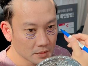 7 Foto Denny Sumargo Operasi Kantung Mata di Korea, Begini Hasilnya