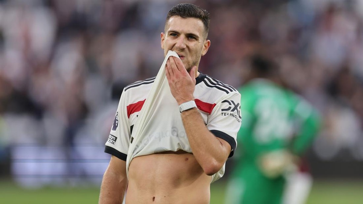 Diogo Dalot. (Foto: Getty Images/Catherine Ivill - AMA)