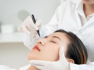 Buccal Fat Removal, Tren Kecantikan untuk Miliki Wajah Tirus Tanpa Diet Buccal Fat Removal, Tren Kecantikan untuk Miliki Wajah Tirus Tanpa Diet