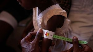 Mencegah Gizi Buruk Anak-anak Haiti