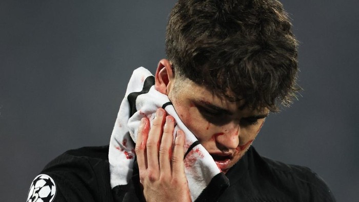 Barcelonas Spanish defender #02 Pau Cubarsi leaves the pitch after suffering an injury during the UEFA Champions League, League phase - Matchday 4 football match between Crvena Zvezda Beograd and FC Barcelona, at the Rajko-Mitic Stadium, in Belgrade, on November 6, 2024. (Photo by Pedja Milosavljevic / AFP)