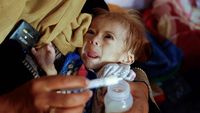 Derita Balita di RS Nasser Khan Younis Gaza