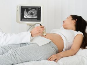 Video Kata Dokter Kandungan Lain soal Viral Oknum Mesum Saat USG Pasien