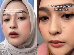 Viral Wanita Curhat Mudah Keringatan Meski di Ruangan ber-AC, Hiperhidrosis?