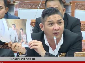 Rapat Bareng Mensos, Pasha Heran Ada Anak Cerebral Palsy Tak Dapat Bansos Rapat Bareng Mensos, Pasha Heran Ada Anak Cerebral Palsy Tak Dapat Bansos