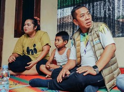 Cabup Aep Beri Semangat Anak Penderita Gagal Ginjal di Karawang