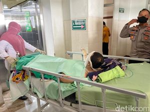 Pria di Ponorogo Tak Sengaja Bakar Rumah Sendiri, Korban Luka Bakar 37%