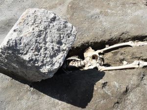 Terungkap Penyebab Tewasnya Orang Paling Tidak Beruntung Sepanjang Sejarah Terungkap Penyebab Tewasnya Orang Paling Tidak Beruntung Sepanjang Sejarah