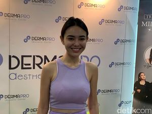 Amanda Manopo Ogah Oplas, Masih Sayang Duit