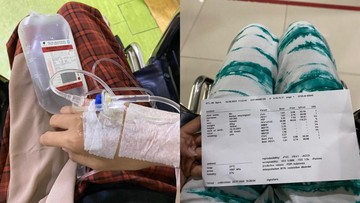 Fakta di balik kasus wanita Jakarta Timur terkena pneumonia, awalnya dianggap masuk angin.